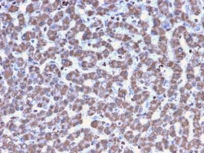 Immunohistochemistry-Paraffin: Prohibitin Antibody (PHB/3194) - Azide and BSA Free [NBP3-08752]