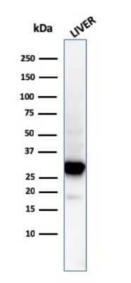 Western Blot: Prohibitin Antibody (PHB/3194) [NBP3-07841]