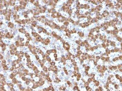 Immunohistochemistry-Paraffin: Prohibitin Antibody (PHB/3225) - Azide and BSA Free [NBP2-79883]