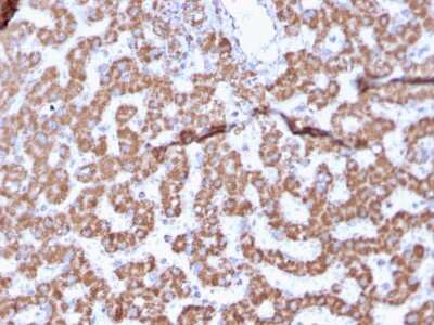 Immunohistochemistry-Paraffin: Prohibitin Antibody (PHB/3225) [NBP2-79748]