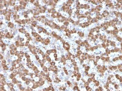 Immunohistochemistry-Paraffin: Prohibitin Antibody (PHB/3225) [NBP2-79748]