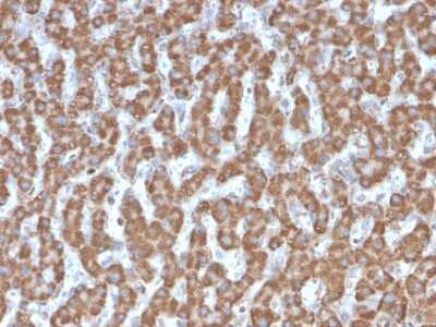 Immunohistochemistry-Paraffin: Prohibitin Antibody (PHB/3226) [NBP3-07843]