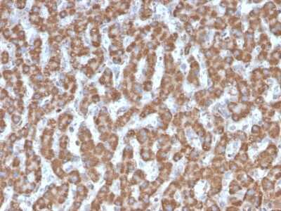 Immunohistochemistry-Paraffin: Prohibitin Antibody (PHB/3226) - Azide and BSA Free [NBP3-08754]