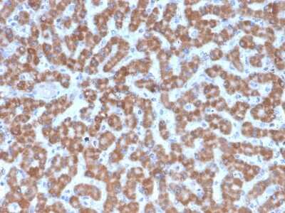 Immunohistochemistry-Paraffin: Prohibitin Antibody (PHB/3227) [NBP3-07856]
