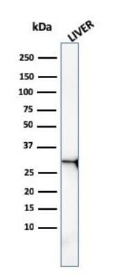 Western Blot: Prohibitin Antibody (PHB/3227) [NBP3-07856]