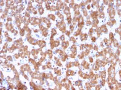 Immunohistochemistry-Paraffin: Prohibitin Antibody (PHB/3228) [NBP3-07857]