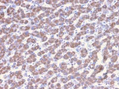 Immunohistochemistry-Paraffin: Prohibitin Antibody (PHB/3228) - Azide and BSA Free [NBP3-08337]