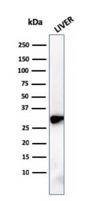 Western Blot: Prohibitin Antibody (PHB/3228) [NBP3-07857]