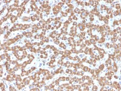 Immunohistochemistry-Paraffin: Prohibitin Antibody (PHB/3229) [NBP3-07602]