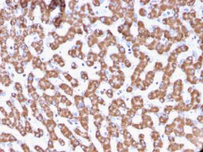 Immunohistochemistry-Paraffin: Prohibitin Antibody (PHB/3229) - Azide and BSA Free [NBP3-08533]