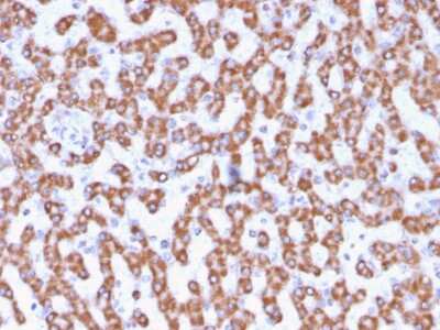 Immunohistochemistry-Paraffin: Prohibitin Antibody (PHB/3230) [NBP3-07817]