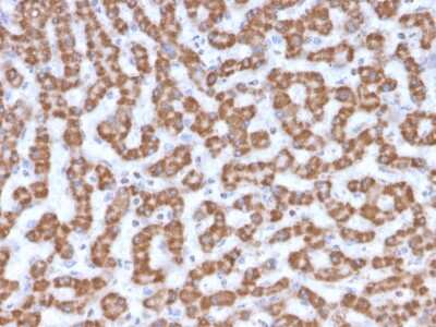 Immunohistochemistry-Paraffin: Prohibitin Antibody (PHB/3230) [NBP3-07817]