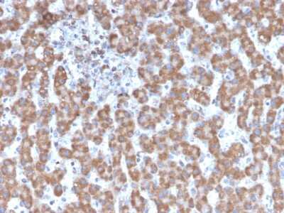 Immunohistochemistry-Paraffin: Prohibitin Antibody (PHB/3231) [NBP2-79744]