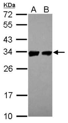 Western Blot: Prohibitin Antibody [NBP2-19944]