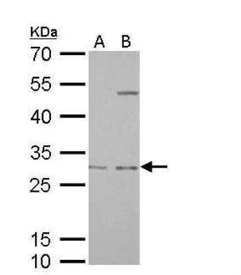 Western Blot: Prohibitin Antibody [NBP2-19944]