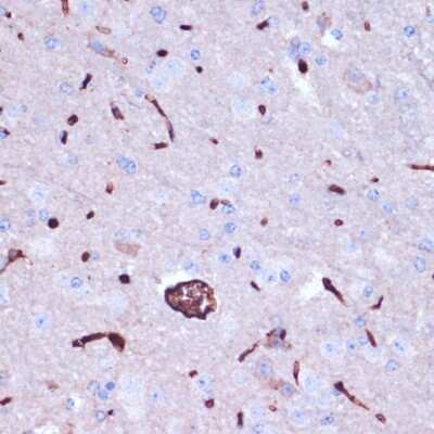 Immunohistochemistry-Paraffin: Prokineticin 2 Antibody - Azide and BSA Free [NBP2-94101]