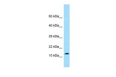 Western Blot: Prokineticin 2 Antibody [NBP2-86756]