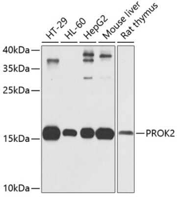 Western Blot: Prokineticin 2 AntibodyAzide and BSA Free [NBP2-94101]