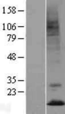 Western Blot: Prokineticin 2 Overexpression Lysate [NBL1-14807]