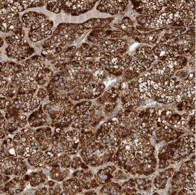 Immunohistochemistry-Paraffin: Prokineticin R1/PROKR1 Antibody [NBP1-83337]