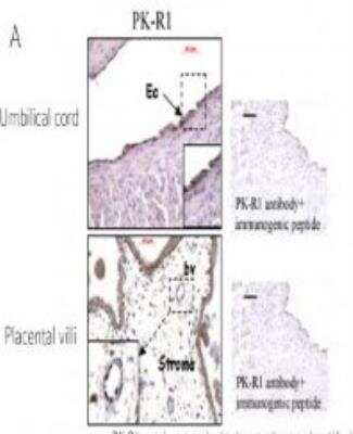 Immunohistochemistry: Prokineticin R1/PROKR1 Antibody [NBP2-15201]