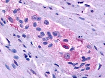 Immunohistochemistry-Paraffin: Prokineticin R1/PROKR1 Antibody - BSA Free [NLS3152]