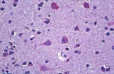 Immunohistochemistry-Paraffin: Prokineticin R2/PROKR2 Antibody [NBP1-45218]