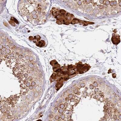 Immunohistochemistry-Paraffin: Prokineticin R2/PROKR2 Antibody [NBP1-92290]