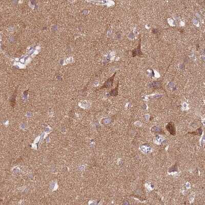 Immunohistochemistry-Paraffin: Prokineticin R2/PROKR2 Antibody [NBP1-92290]