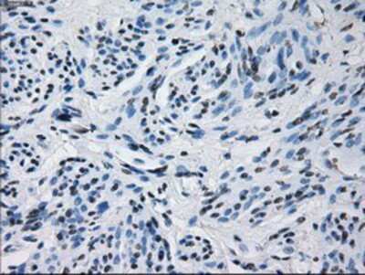 Immunohistochemistry-Paraffin: Prolactin Antibody (OTI6B1) [NBP2-02142]