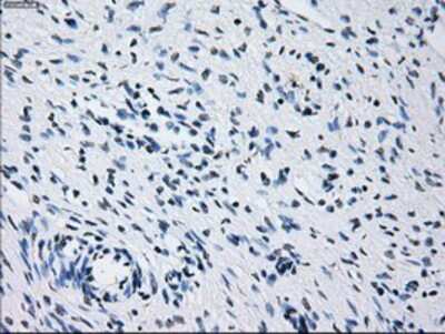 Immunohistochemistry-Paraffin: Prolactin Antibody (OTI6B1) [NBP2-02142]
