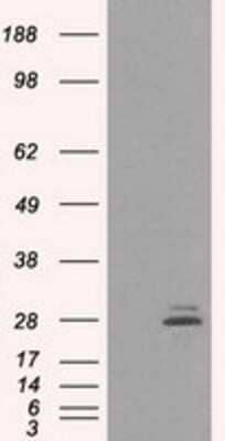 Western Blot: Prolactin Antibody (OTI6B1) [NBP2-02142]