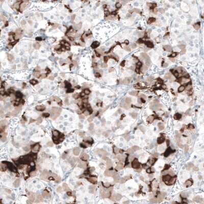Immunohistochemistry-Paraffin: Prolactin Antibody (CL6550) [NBP2-76502]