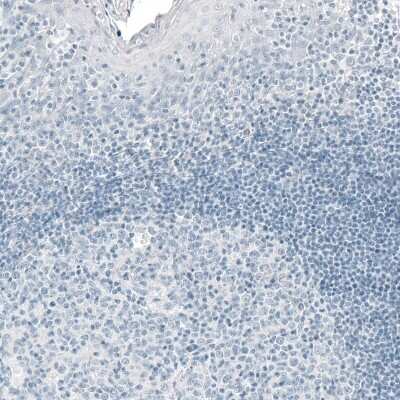 Immunohistochemistry-Paraffin: Prolactin Antibody (CL6550) [NBP2-76502]