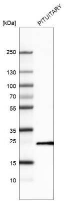 Western Blot: Prolactin Antibody (CL6550) [NBP2-76502]