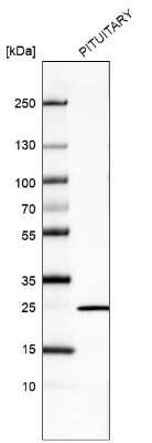 Western Blot: Prolactin Antibody (CL6553) [NBP2-76503]