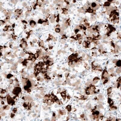 Immunohistochemistry-Paraffin: Prolactin Antibody (CL6559) [NBP2-76505]