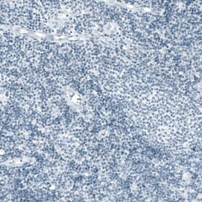 Immunohistochemistry-Paraffin: Prolactin Antibody (CL6559) [NBP2-76505]