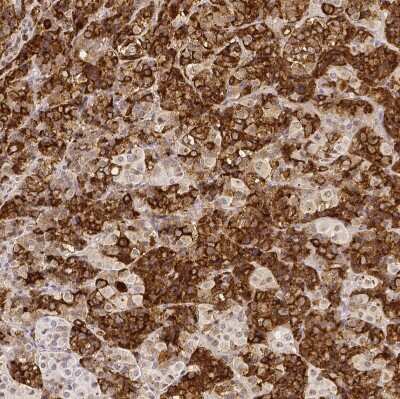 Immunohistochemistry-Paraffin: Prolactin Antibody [NBP2-56148]