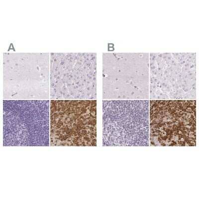 Immunohistochemistry-Paraffin: Prolactin Antibody [NBP2-59010]