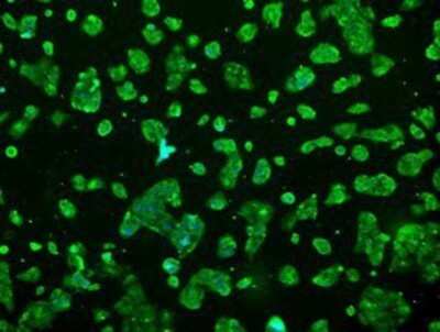 Immunocytochemistry/ Immunofluorescence: Prolactin Antibody (OTI6B1) - Azide and BSA Free [NBP2-73609]