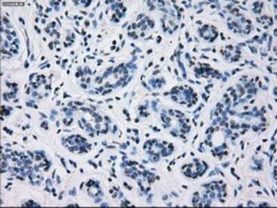 Immunohistochemistry: Prolactin Antibody (OTI6B1) - Azide and BSA Free [NBP2-73609]