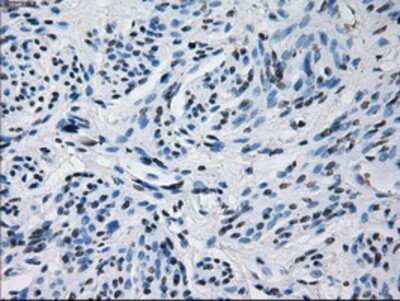 Immunohistochemistry: Prolactin Antibody (OTI6B1) - Azide and BSA Free [NBP2-73609]