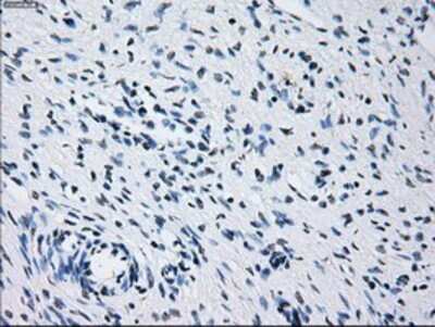 Immunohistochemistry: Prolactin Antibody (OTI6B1) - Azide and BSA Free [NBP2-73609]