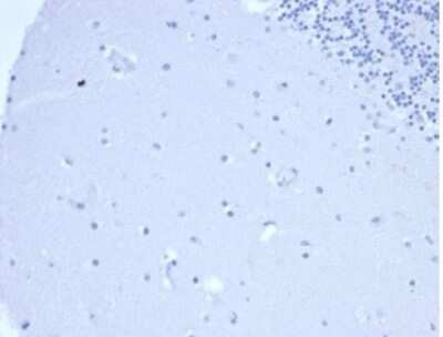 Immunohistochemistry-Paraffin: Prolactin Antibody (PRL/4906R) [NBP3-13755]