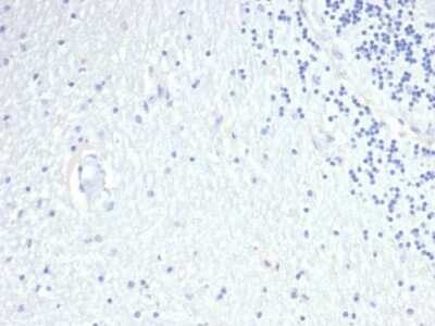 Immunohistochemistry-Paraffin: Prolactin Antibody (PRL/4908R) - Azide and BSA Free [NBP3-08249]