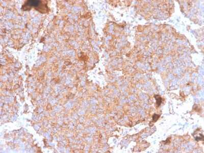 Immunohistochemistry-Paraffin: Prolactin Antibody (PRL/4908R) [NBP3-07241]