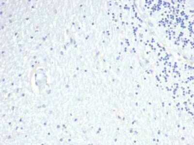 Immunohistochemistry-Paraffin: Prolactin Antibody (PRL/4908R) [NBP3-07241]