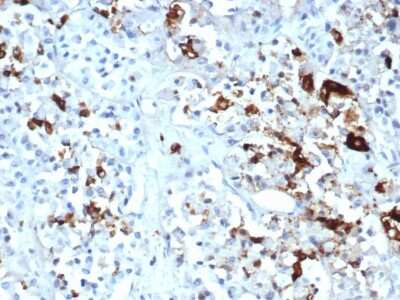 Immunohistochemistry-Paraffin: Prolactin Antibody (PRL/4908R) [NBP3-07241]