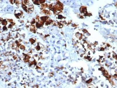 Immunohistochemistry-Paraffin: Prolactin Antibody (rPRL/4909) - Azide and BSA Free [NBP3-08245]